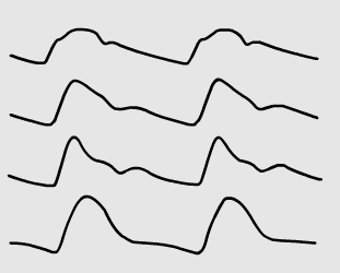 Central Pressure Waveform Animations