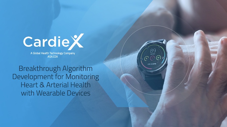 CardieX Presentation Wearables Devices Update