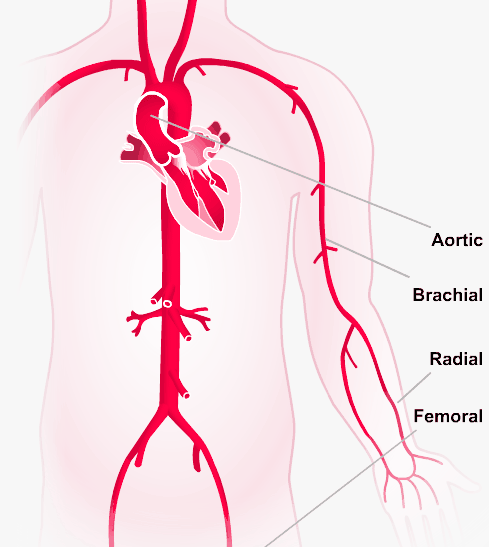 Arterial reflection sites